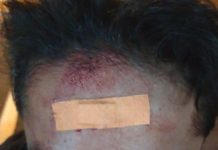 Sebuah insiden penganiayaan terhadap tiga remaja viral di media sosial setelah diunggah akun Instagram @merapi_uncover pada Rabu (14/5/2025). Kejadian yang terjadi Selasa (13/5/2025) malam sekitar pukul 23.00 WIB itu menampilkan permintaan bantuan untuk mencari rekaman CCTV di sepanjang Jalan SMSR, khususnya di area warung Madura.