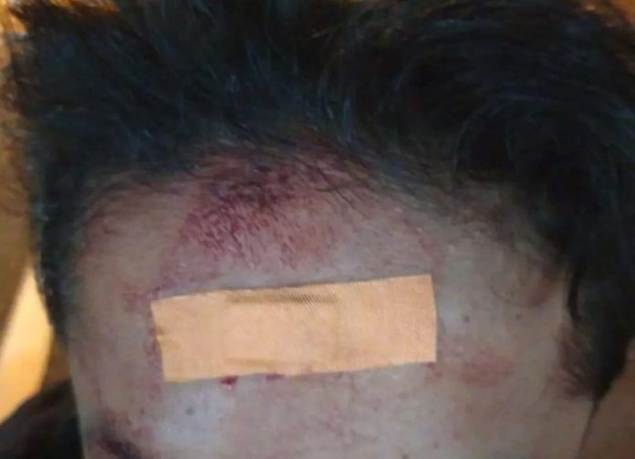 Sebuah insiden penganiayaan terhadap tiga remaja viral di media sosial setelah diunggah akun Instagram @merapi_uncover pada Rabu (14/5/2025). Kejadian yang terjadi Selasa (13/5/2025) malam sekitar pukul 23.00 WIB itu menampilkan permintaan bantuan untuk mencari rekaman CCTV di sepanjang Jalan SMSR, khususnya di area warung Madura. Sebuah insiden penganiayaan terhadap tiga remaja viral di media sosial setelah diunggah akun Instagram @merapi_uncover pada Rabu (14/5/2025). Kejadian yang terjadi Selasa (13/5/2025) malam sekitar pukul 23.00 WIB itu menampilkan permintaan bantuan untuk mencari rekaman CCTV di sepanjang Jalan SMSR, khususnya di area warung Madura.