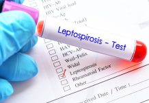 Ilustrasi Leptospirosis (Foto: Istimewa)